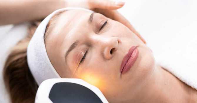 PhotoFacial (IPL)